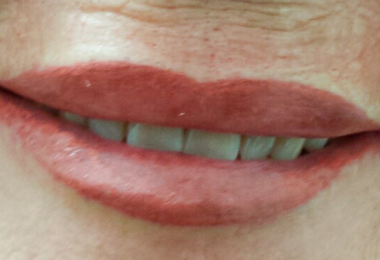 Lips