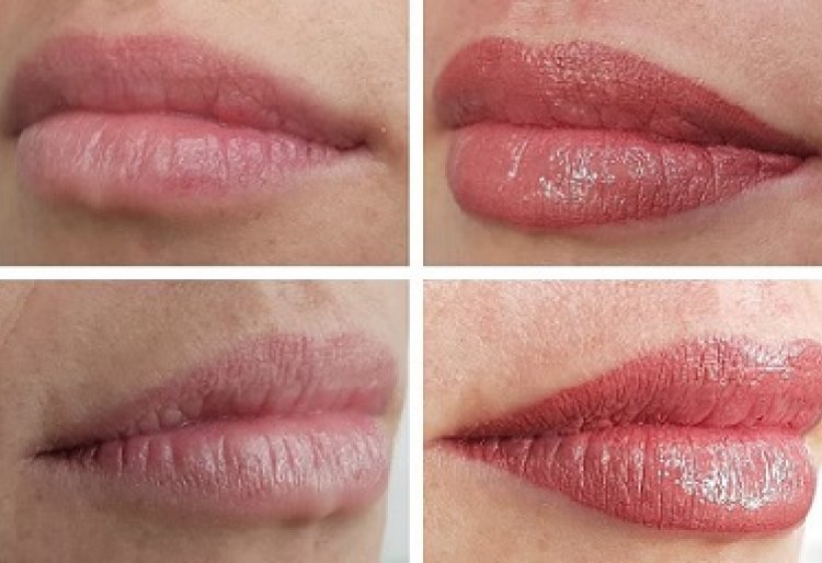 Lips
